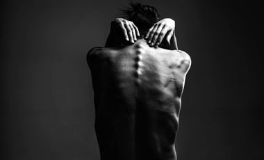 Thin body with bones showing